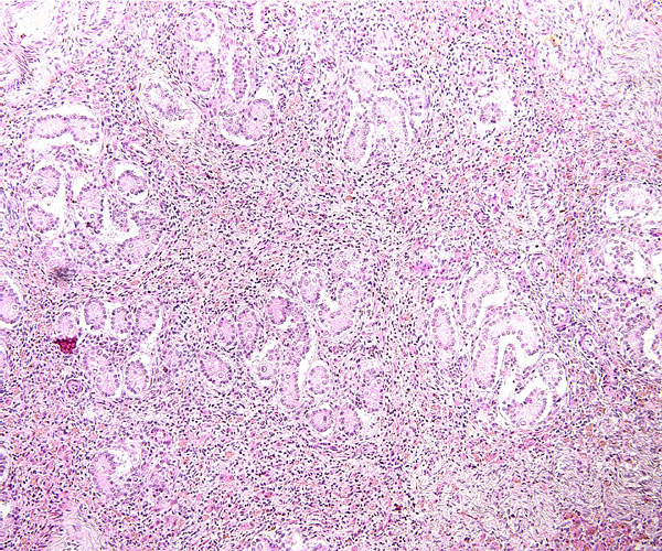 Low power view of testis of neonatal kiang. The large mass of slightly brown-tinged interstitial cells is similar to that of the horse neonate