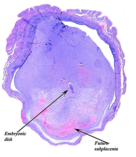 Adjacent section from previous slide with embryo.