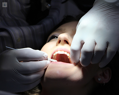 Paciente con la boca abierta, siendo intervenida por un dentista - muelas del juicio - by Top Doctors