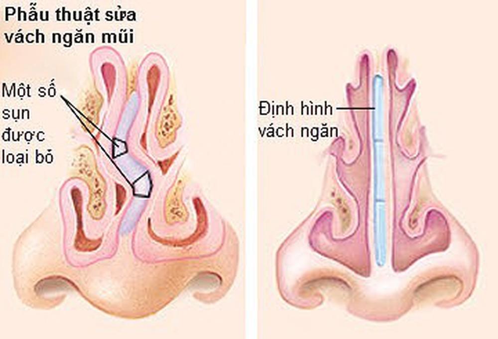 HÃ¬nh áº£nh cÃ³ liÃªn quan