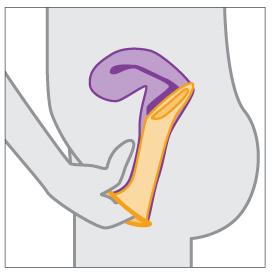 Finger inserting female condom into vagina.