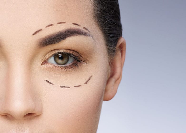 Blepharoplasty Surgical Procedures at SDMD in Chicago