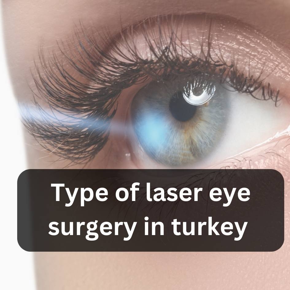 type of laser eye surgery in Turkey