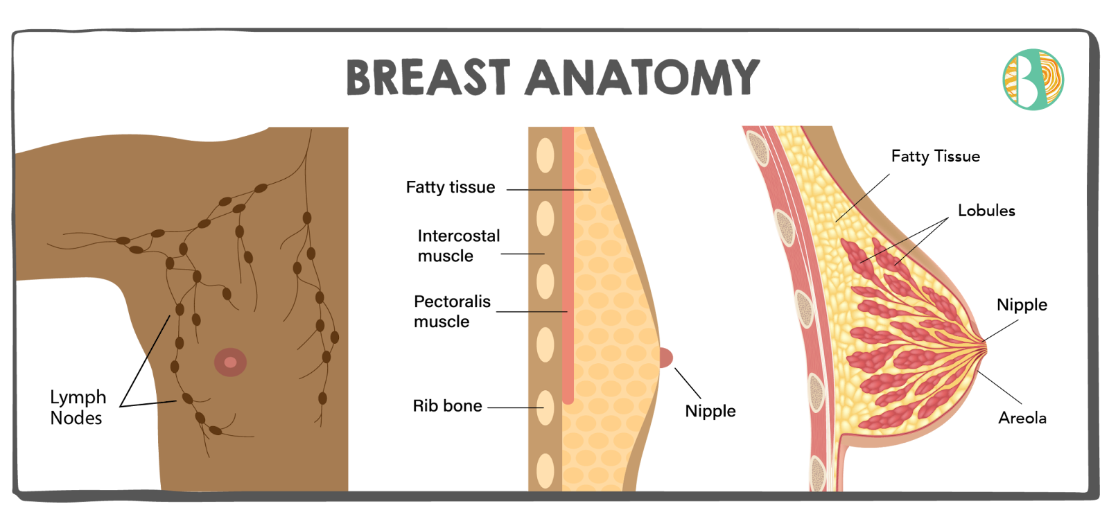 Breast Anatomy graphic, lymph nodes, fatty tissue, intercostal muscle, pectorialis muscle, rib bone, nipple, areola