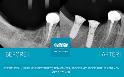 Photos of Dr. Akram Bekdache Dental Clinic عيادة الدكتور أكرم بكداش