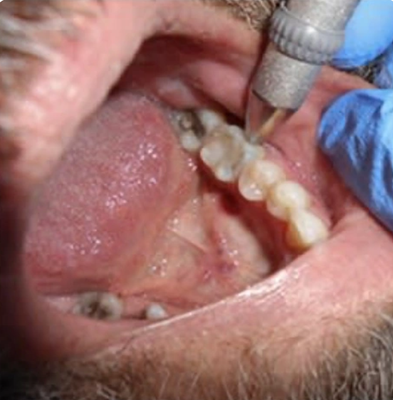 A Clinician’s Guide to Clinical Endodontics