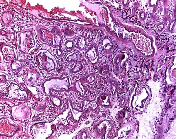 Labyrinth with fetal vessel in chorion above and diffusely branched villous connective tissue, covered by trophoblast
