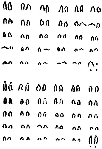 Karyotypes of male and female sable antelopes