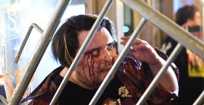 Un estudiante herido durante las violentas manifestaciones. | NOAH BERGER (EFE)