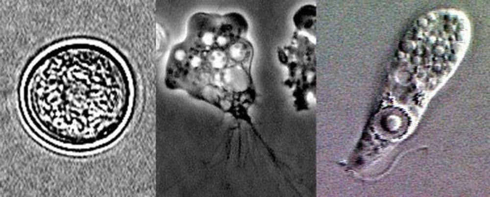 braineatingamoeba