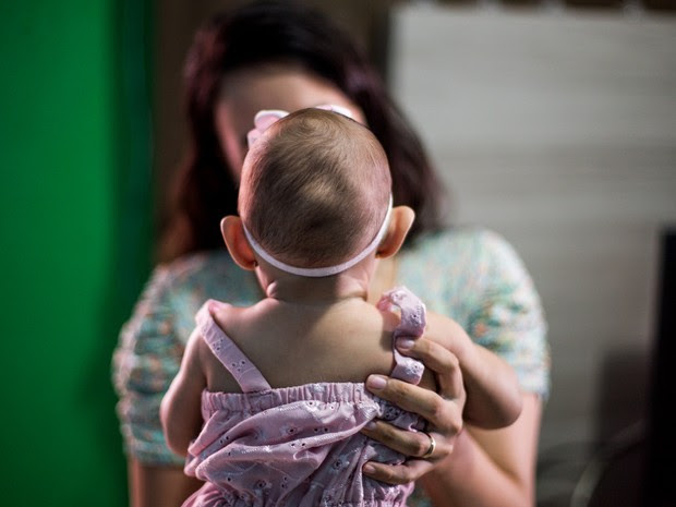 Ministério da Saúde pode mudar critérios para triagem de bebês com problemas relacionados ao vírusda zika: 20% têm cabeça de tamanho normal  (Foto: Jonathan Lins/G1)