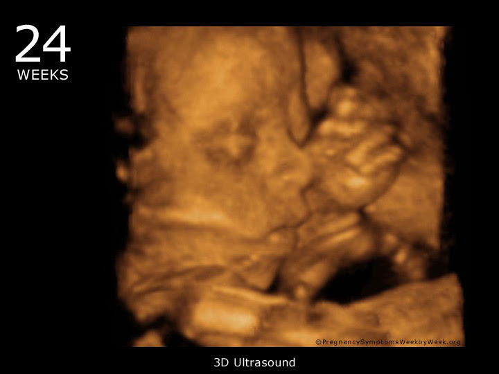 24 week ultrasound 3D