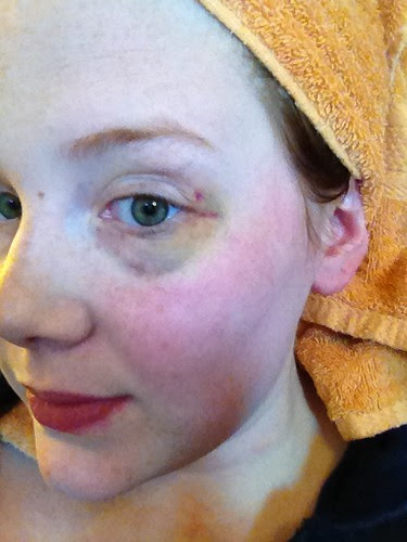 photo-13