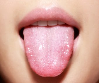 papilloma virus uomo lingua