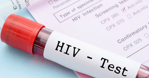 Hakan Leblebicioğlu HIV testi pozitif çıkarsa ne yapılmalıdır? - Hakan Leblebicioğlu