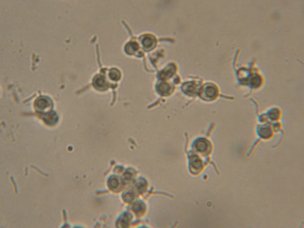 Mushroom Spores Microscope - All Mushroom Info