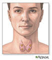 picture of thyroid gland