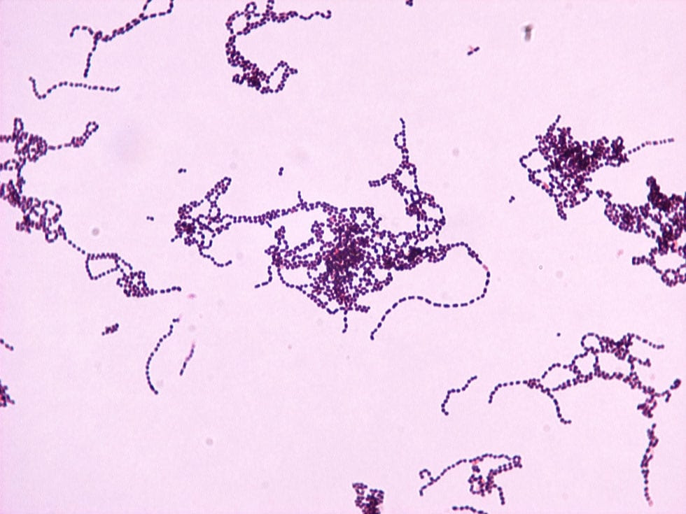 Streptococcus Pneumoniae Strep Pneumo Gram Stain Slide Share