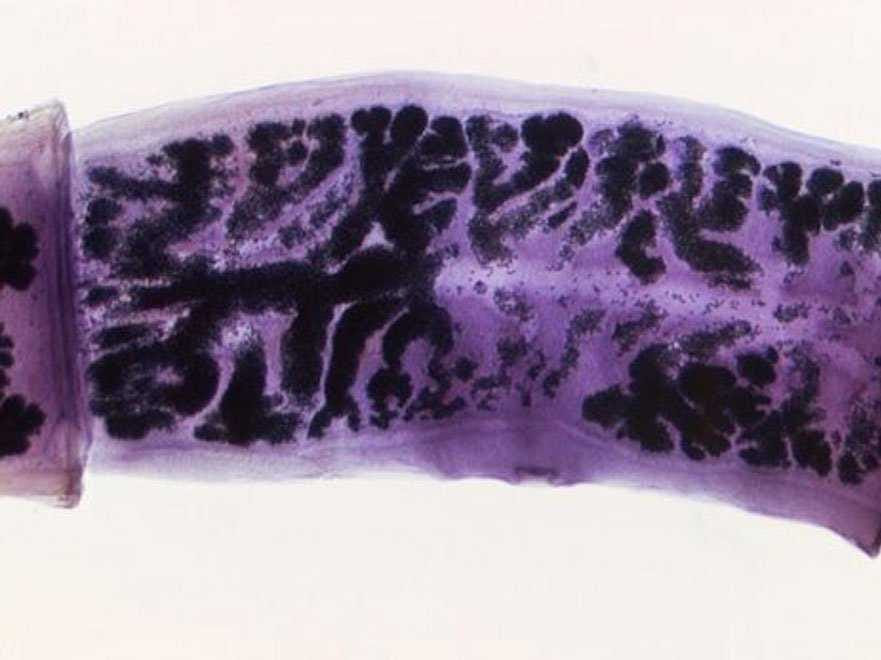 porktapeworm