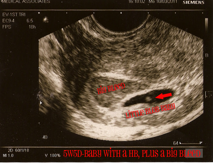 5w5d copy