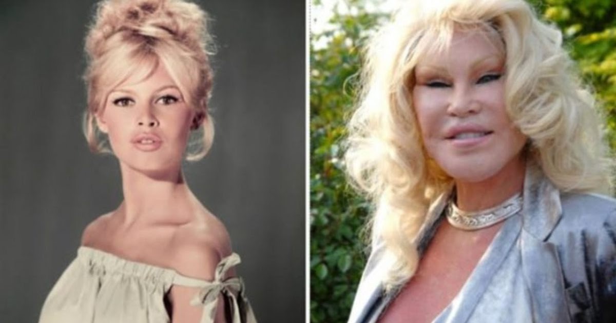 10 EPIC CELEBRITY PLASTIC SURGERY DISASTERS - MixTrends