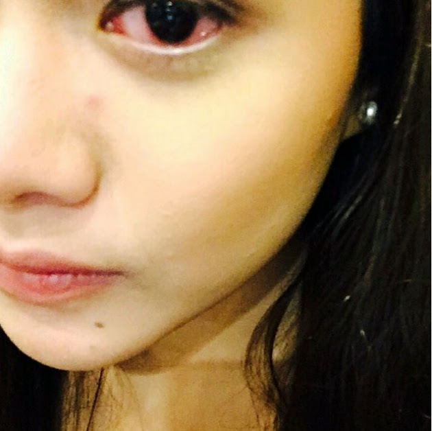 Unggah Foto Mata Merah Aurel Hermansyah Sakit Mata atau Unggah Foto Mata Merah Aurel Hermansyah Sakit Mata atau