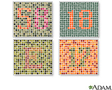 Illustration of various tests for color blindness Illustration of various tests for color blindness