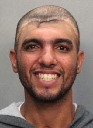 Does the suspect have any distinguishing features? Police release mind-bending mugshot 