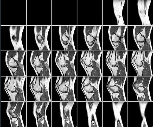 Image:MRI-Knee-Example.jpg