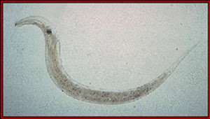 pinworm magnified