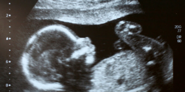 A foetus ultrasound. Photo / Thinkstock