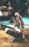 A starved Biafran Boy