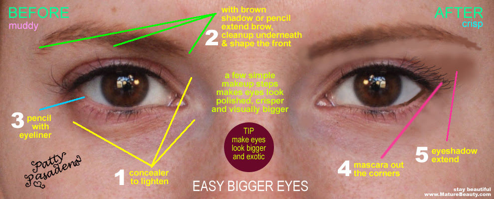 Plastic surgery to make your eyes look bigger