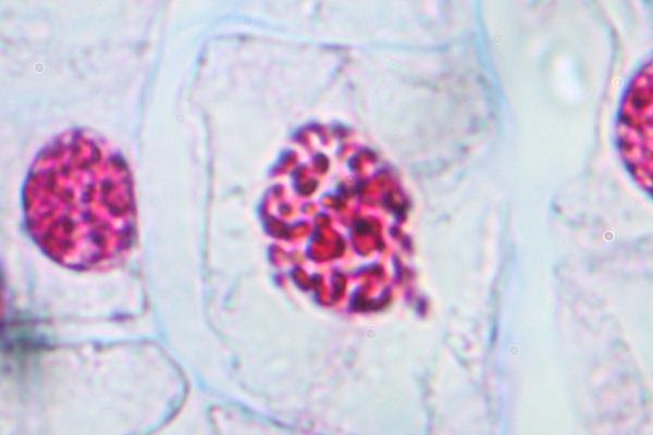 animal cell prophase