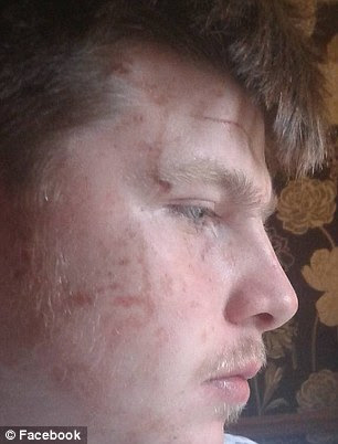 The same teen has visible injuries to the surface of his face