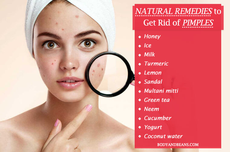 How To S Wiki 88 How To Get Rid Of Pimples