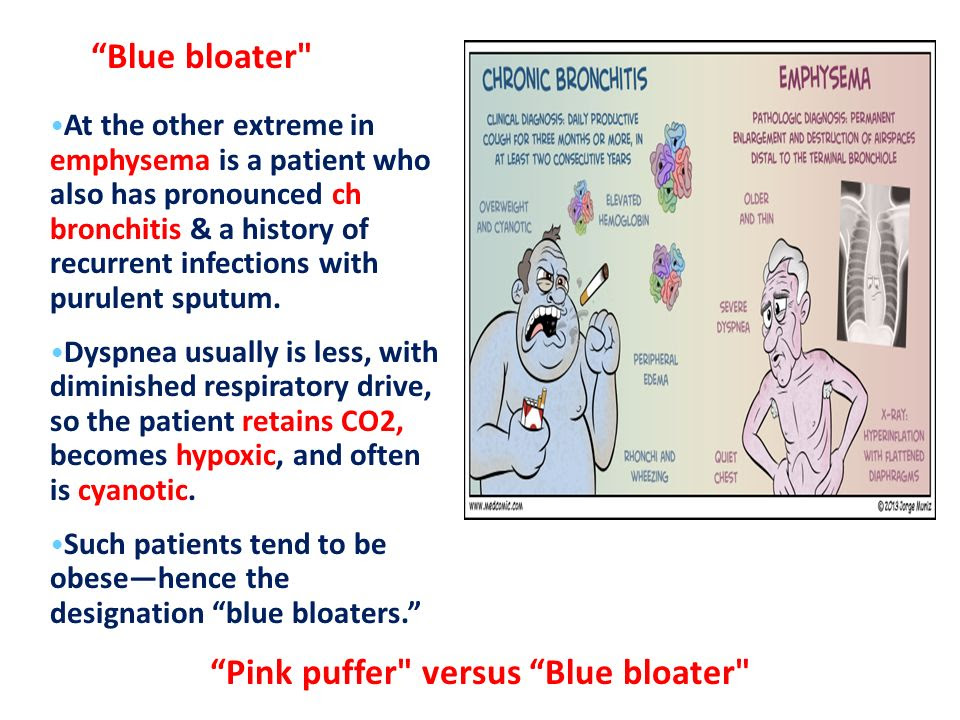 copd blue bloaters and pink puffers, 2 Types of patterns in COPD – “Pink  Puffer & Blue bloater” – medstudentstruggles - themaintenancecorner.com
