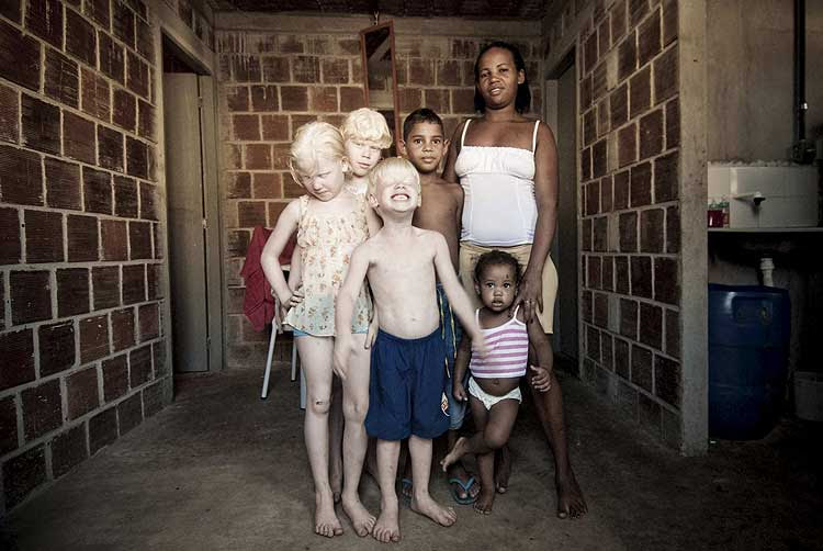papa açordas: Tres hermanos albinos