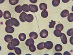 Thumbnail of Spirochetes on a thick peripheral blood smear from a patient with tick-borne relapsing fever, southern Spain, 2004–2015.