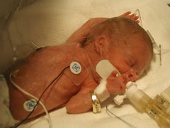 Lindsey - a month old