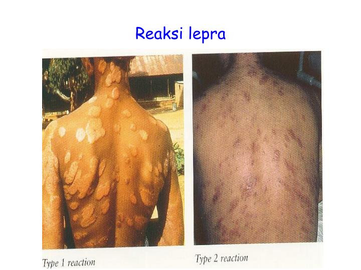 PPT KUSTA PowerPoint Presentation ID 5576201 PPT KUSTA PowerPoint Presentation ID 5576201