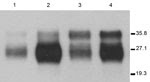 Thumbnail of Immunoblots of brain extracts from hemizygous 113LBoPrP-Tg037+/− 113LBoPrP-Tg009+/− mouse lines compared with those of cow brain extract and BoPrP-Tg110 mouse brain extract. Brain homogenates were analyzed by Western blotting with monoclonal antibody 2A11 (30). Lane 1, 113LBoPrPTg-009; lane 2, 113LBoPrPTg-037; lane 3, Cow; lane 4, BoPrPTg-110. Equivalent amounts of total protein were loaded into each lane. 113L, leucine substitution at codon 113; BoPrP, bovine prion protein. Values 