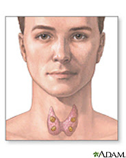Illustration of the thyroid showing the parathyroid glands