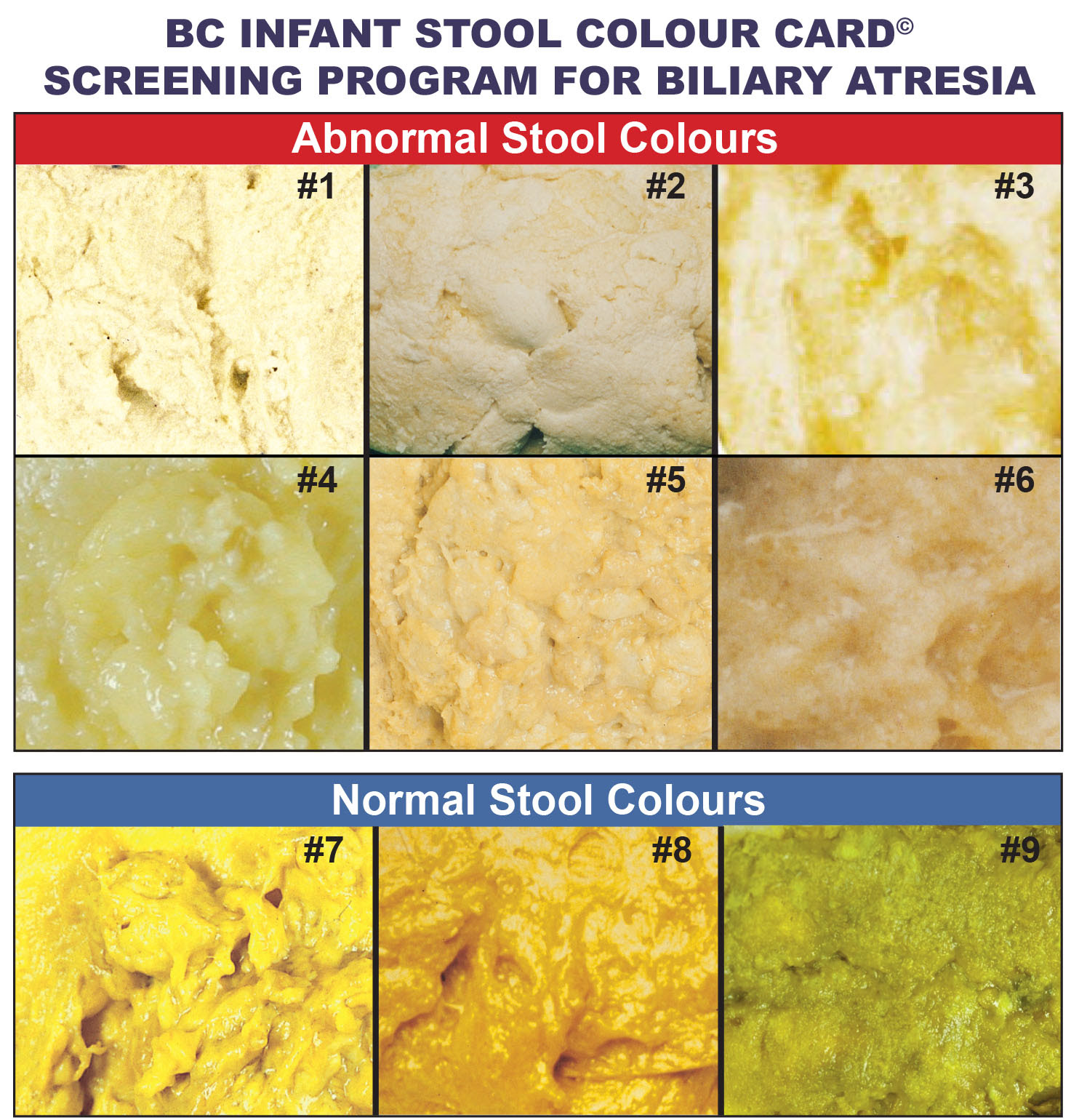 Collection 94+ Pictures Pictures Of Abnormal Stool Samples Latest 10/2023