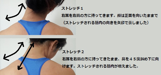 イメージカタログ 新しい 肩 筋肉 落とす