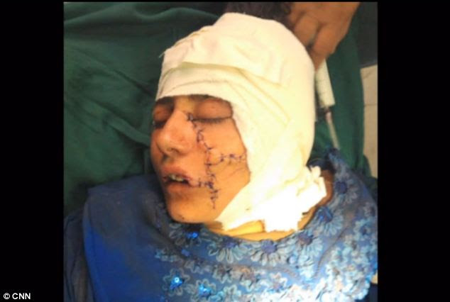 Gul Meena's brother thought he had killed her but surgeons were able to save her life