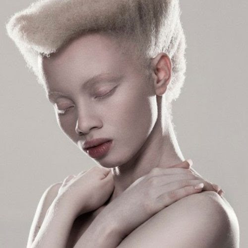 A beleza única dos albinos A beleza única dos albinos