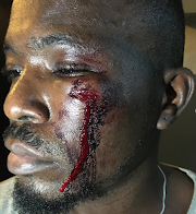 Man asks for justice after he was battered by Lagos touts for no reason