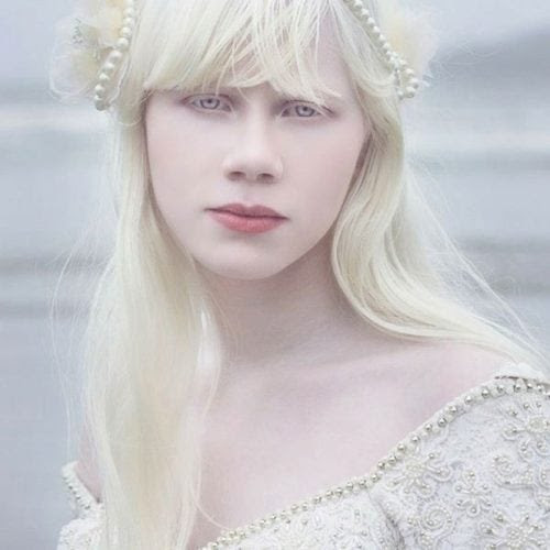 A beleza única dos albinos A beleza única dos albinos