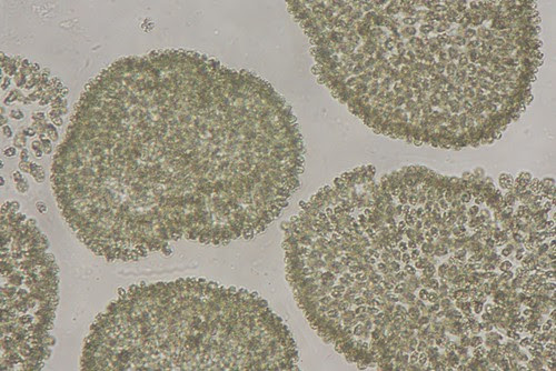 Imagen microscópica de Microcystis aeruginosa. Autor Eduardo Costas